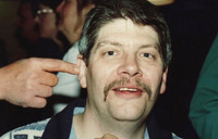 Stanton M. Laser & John's Finger